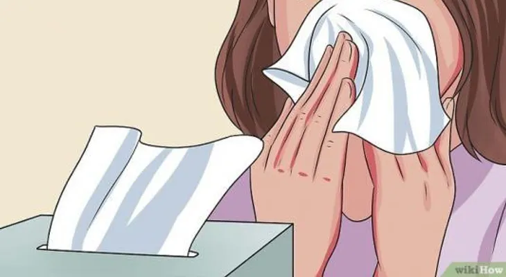 Anota estos 5 remedios caseros para tratar la rinitis alérgica de manera efectiva