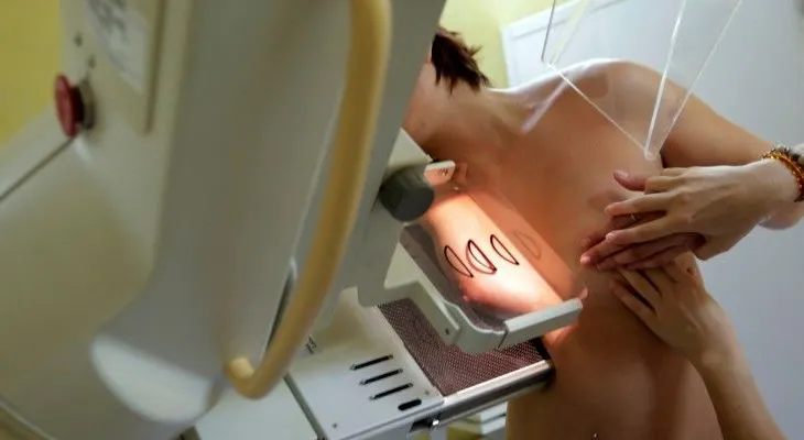 Error en detección de cáncer de mama podría haber acortado la vida de cientos de mujeres en el Reino Unido