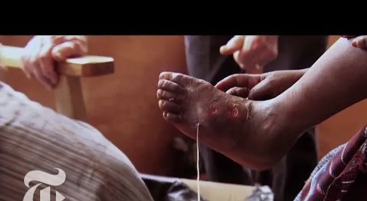 4 parásitos humanos que no querrás tener (VIDEO)
