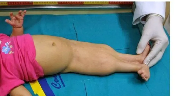 Nace un bebé Sirena; tiene que mirarlo