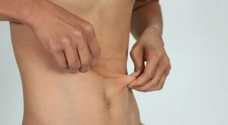 ¿Por qué las personas delgadas pueden desarrollar diabetes tipo 2?