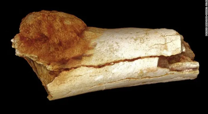 Científicos hallan cáncer en un fósil de más de un millón de años (VIDEO)