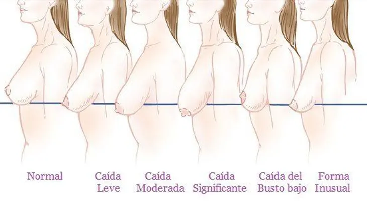 Hábitos diarios que causan un busto caído
