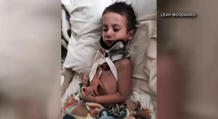 Un niño sobrevivió a una decapitación interna sin cirugía