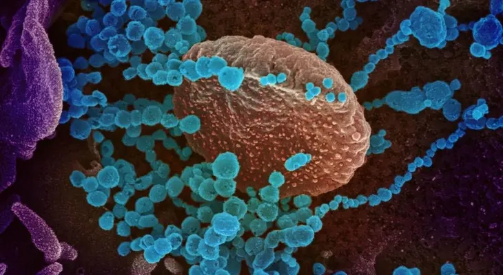 Crean inhibidores que bloquean interacción entre SARS-Cov-2 y receptor humano
