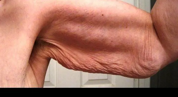 Esta es la forma de eliminar para siempre la FLACIDEZ de los brazos; solo necesita:
