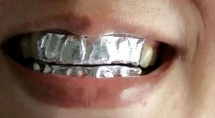 El truco perfecto para blanquear tus dientes con papel de aluminio