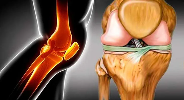 Como reparar nuestros cartílagos con vitamina 
