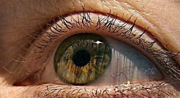 La vitamina B3 podría ser muy eficaz para prevenir el glaucoma