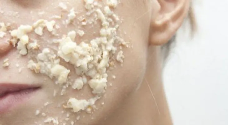 Dile adiós a las espinillas y el acné con esta mascarilla