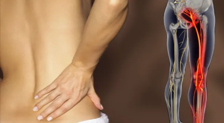 Olvidate del dolor de la espalda con estos remedios 