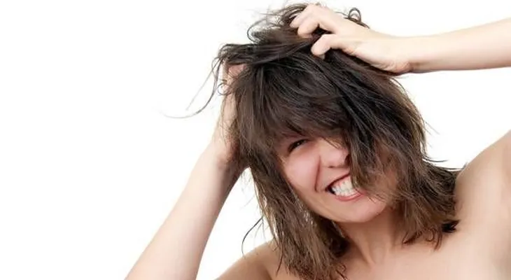 ¿Tenés caspa? Consejos fáciles para prevenirla