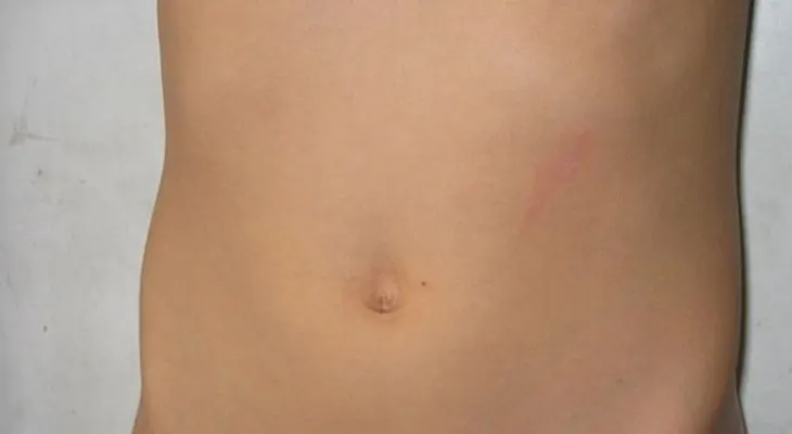 Por qué tu panza es así 
