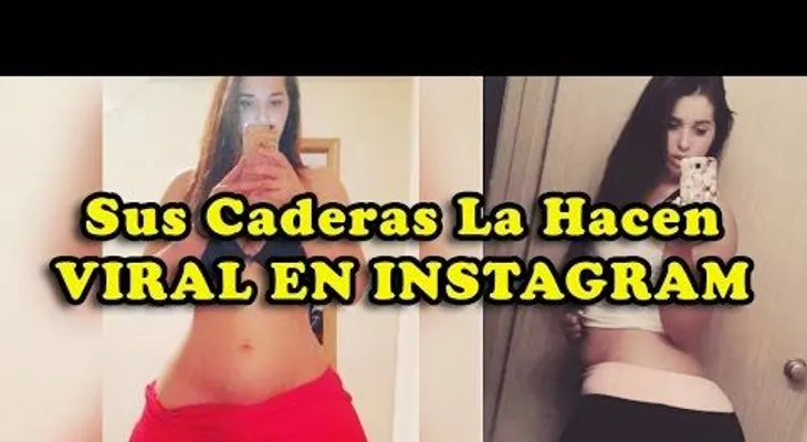 Sufre de una rara enfermedad llamada Linfedema, que le hace tener las caderas más grandes del mundo (VIDEO)