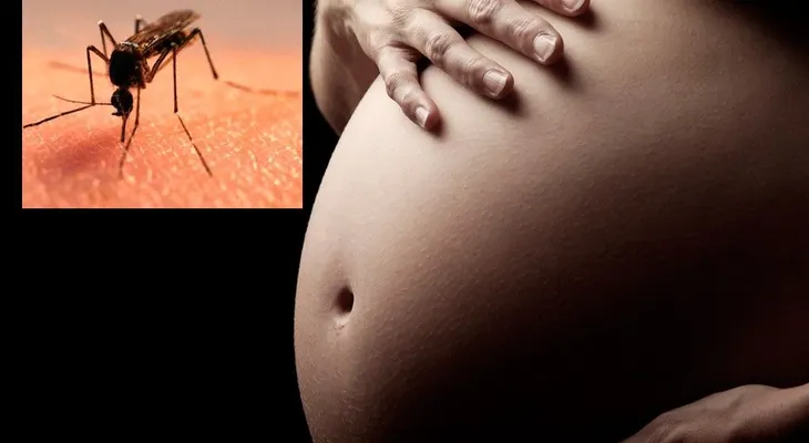 Primer caso de zika en una mujer embarazada en Singapur