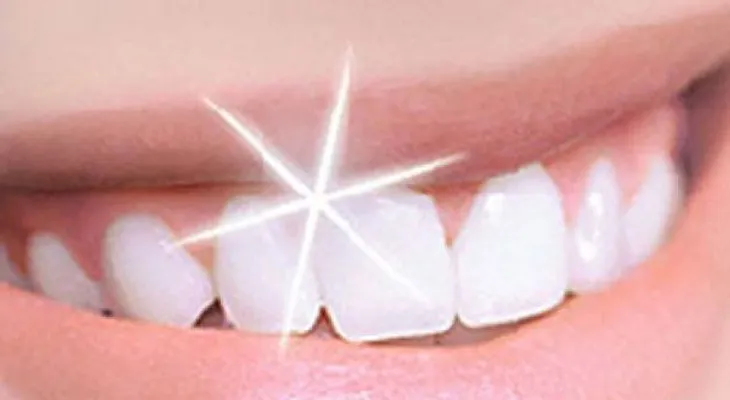 5 alimentos para blanquear los dientes
