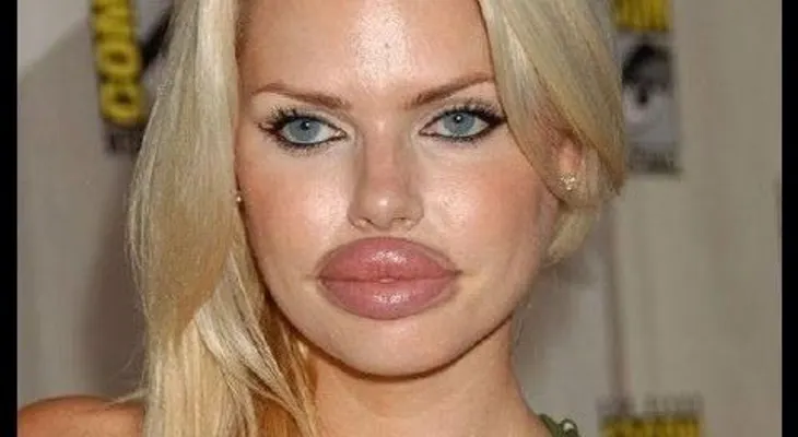 Labios estropeados (FAMOSOS) !!!