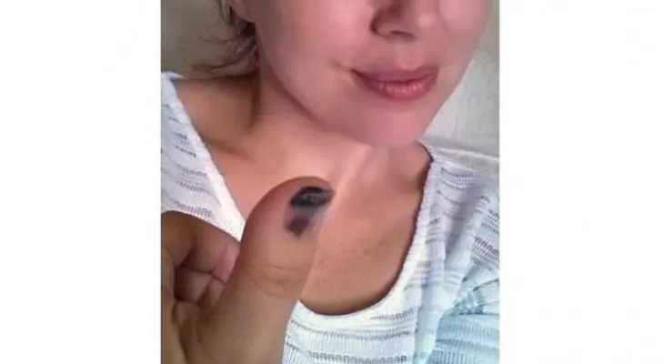 ¿Ven eso en mi pulgar? Es cáncer de piel