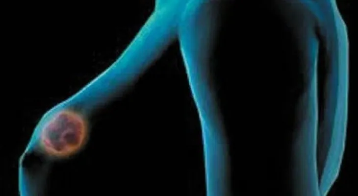Inventan unas gafas que pueden 'ver' el cáncer