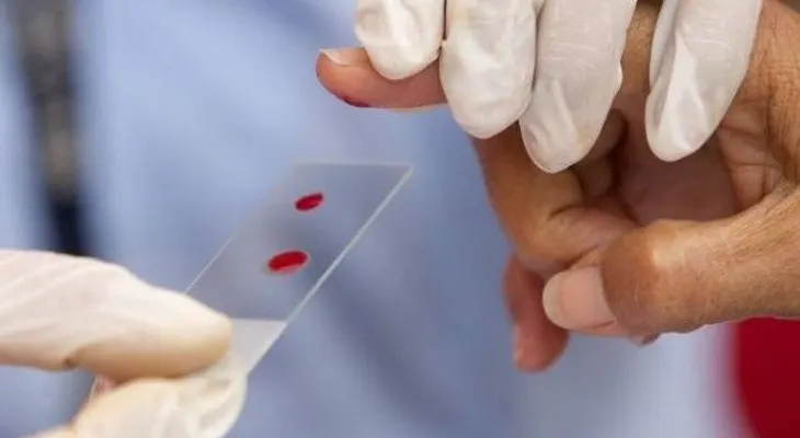 Análisis de sangre detecta virus afectaron a una persona en su vida