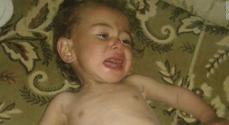 Hambruna en Siria: lo que se vive en Madaya solo es la punta del iceberg