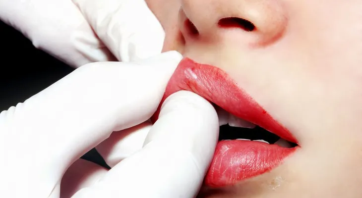 ¿El Botox es la nueva panacea? Los increíbles usos posibles de la droga