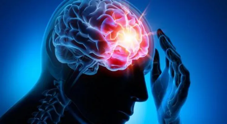 Las cuatro enfermedades cerebrovasculares más comunes que debes conocer