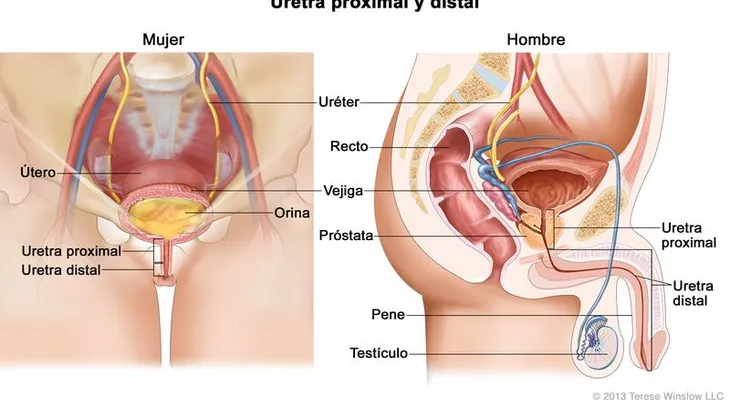 Urólogos preocupados por aumento cáncer de vejiga