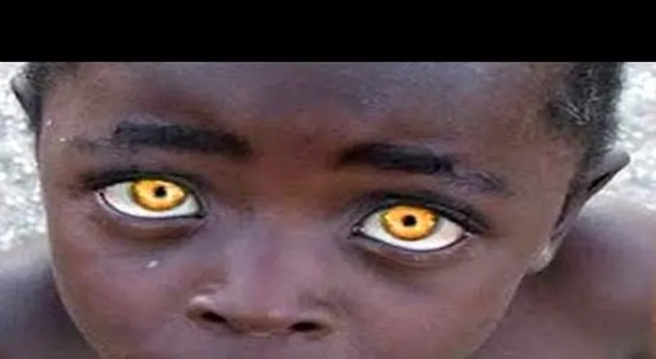 Estas son las 10 personas con color de ojos únicos en el MUNDO 