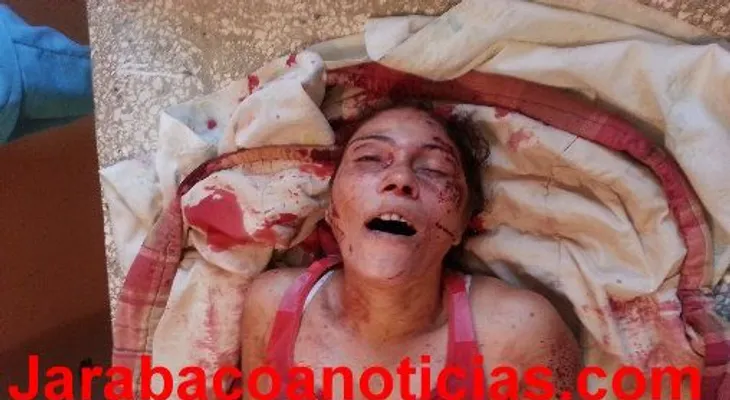 Goma se le salió a un camión y mata mujer en la 6 de Noviembre