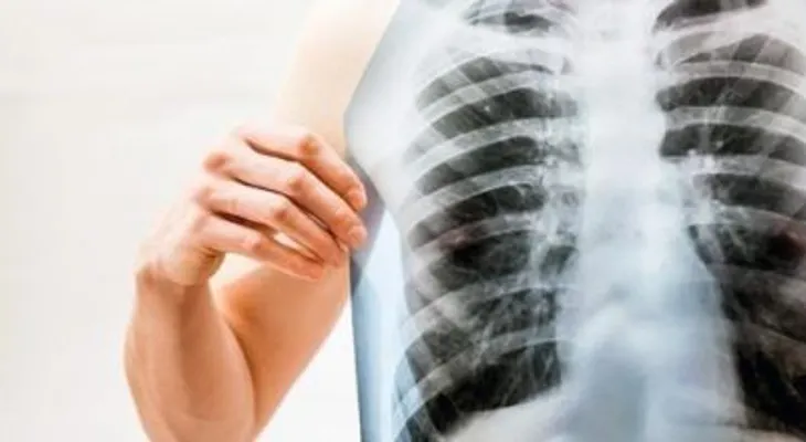Como limpiar tus pulmones de la nicotina