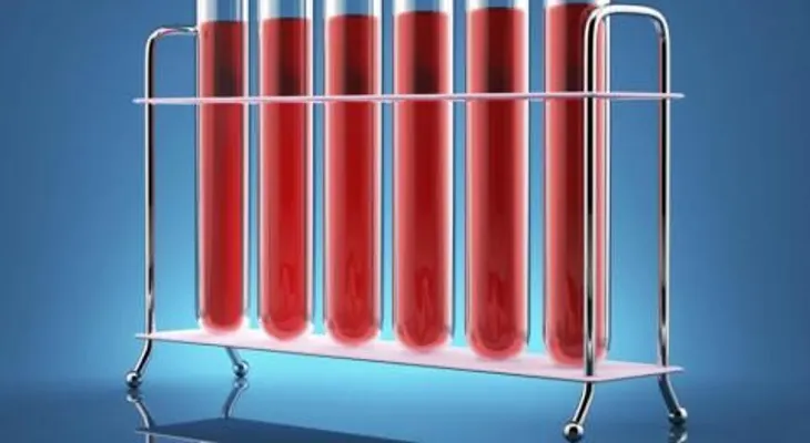 Cómo detectar los resultados de un análisis de sangre