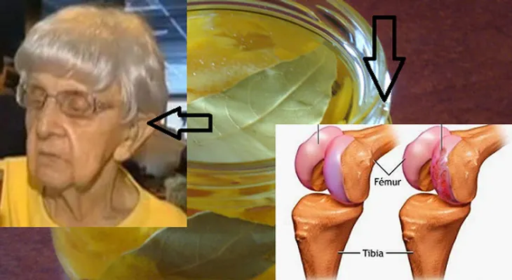 Ella tenía 75 años y casi no podía caminar, hasta que le dieron para tomar esto y hoy sus articulaciones están como las de una persona de 40