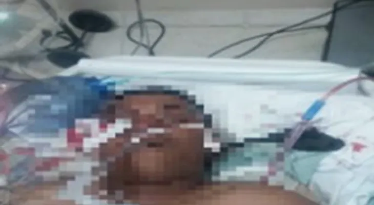 Presenta un edema cerebral raso PN que le propinaron un disparo en la cabeza