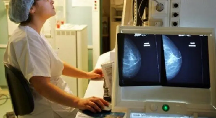 Mujeres pueden esperar hasta los 45 años para hacerse una mamografía