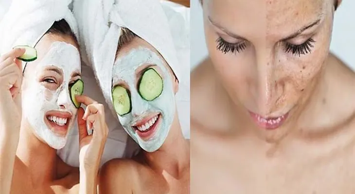 De que funciona, funciona: Una receta que eliminas las manchas de tu piel y rostro!