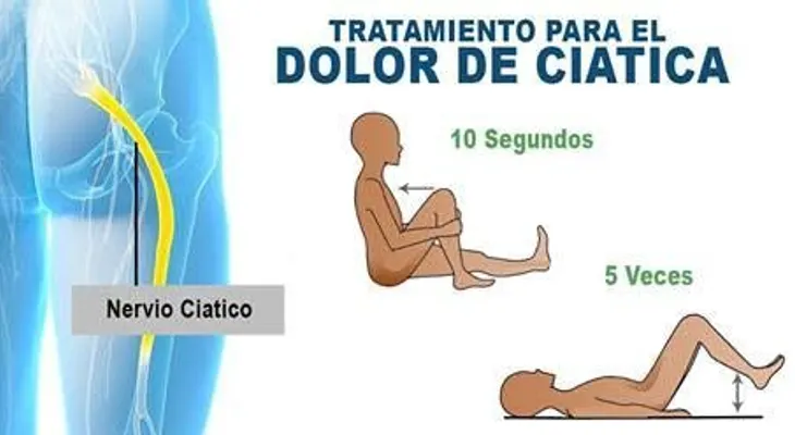 El dolor de la CIATICA nunca más será un problema: Solo pon atención (VIDEO)