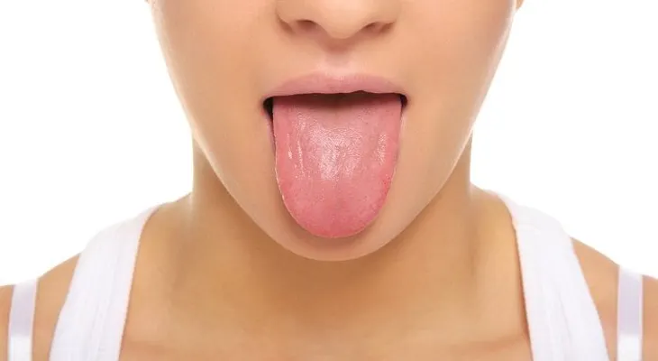 Color y textura de la lengua y su significado