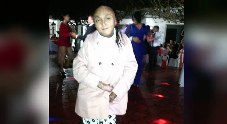 Muere Jessica Ramírez, la joven colombiana con piel de mariposa