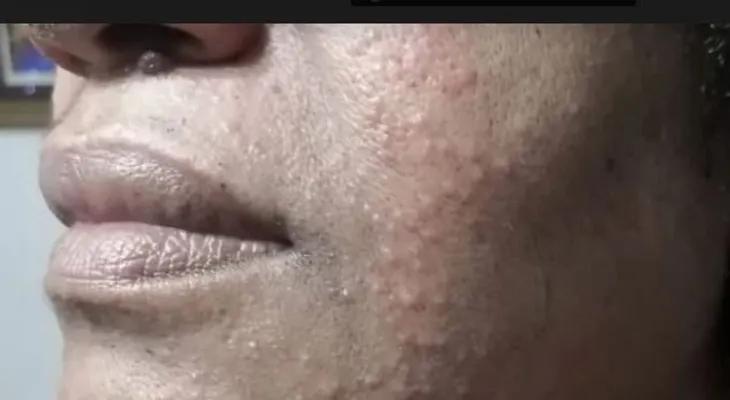 Mascarilla produce reacción rostro de la presidenta del CDP 