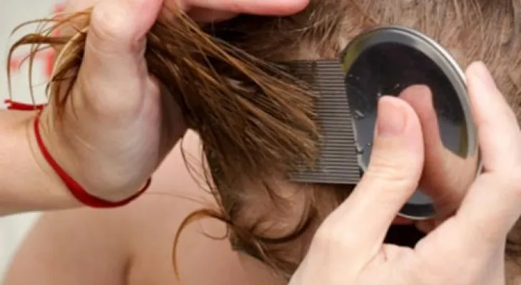 Los piojos y liendras se eliminan con estos 7 remedios