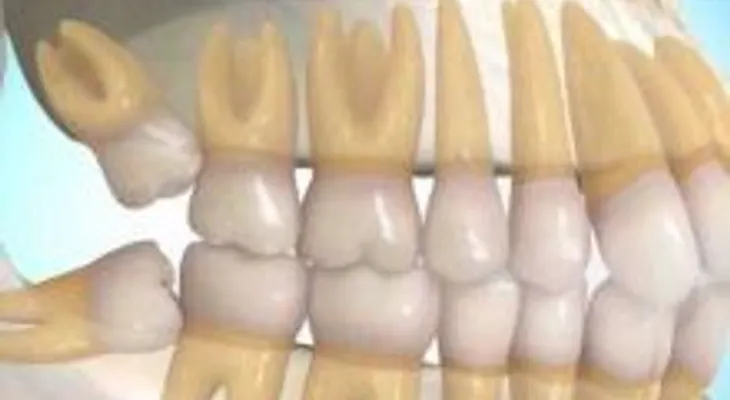 Esta es la estafa dental más grande del MUNDO: los odontólogos te dicen otra cosa