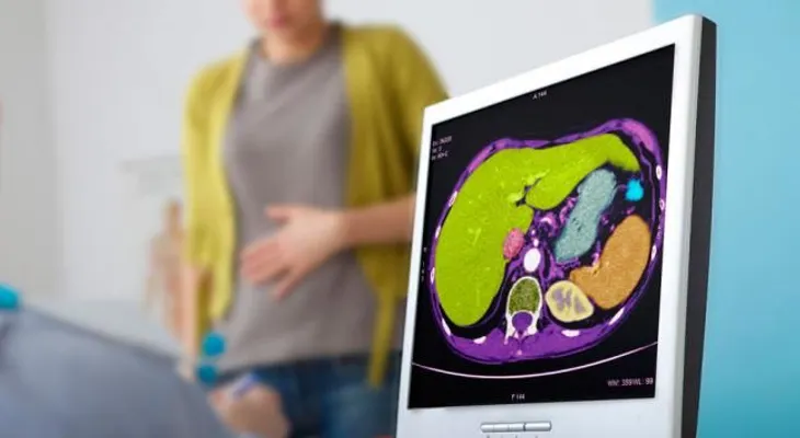 Nuevos tratamientos contra la hepatitis C, disponibles en España