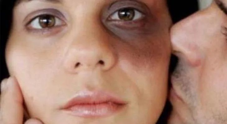 Si una mujer acepta estas 5 cosas de un hombre, debe ir ahora mismo donde un psicólogo