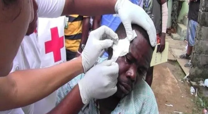Hieren haitiano de una pedrada en oficina de regularización