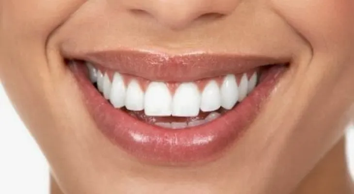 10 tips para fortalecer tus dientes