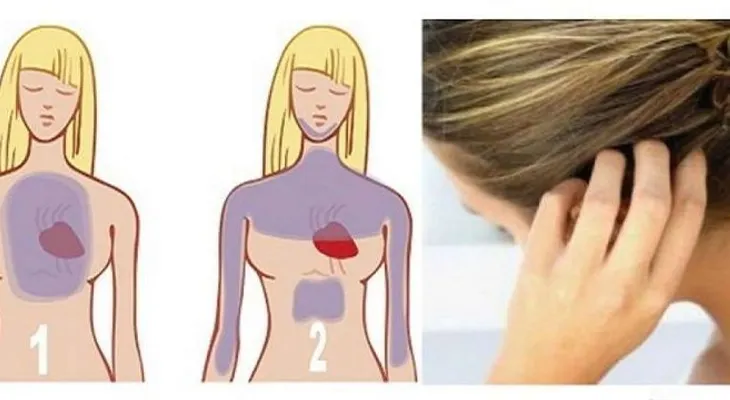 Cómo utilizar tu cabello para saber si vas a tener un ataque al corazón y prevenirlo