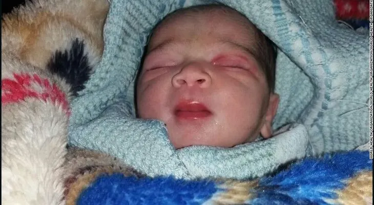 Esta es la primera niña en nacer entre los evacuados de Aleppo