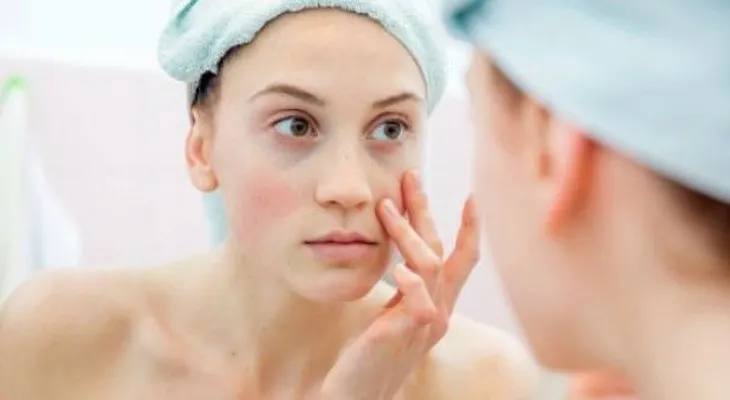 Las ojeras revelan tu actitud hacia la vida