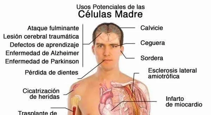Video: Terapia con células madres: esperanzas y mentiras